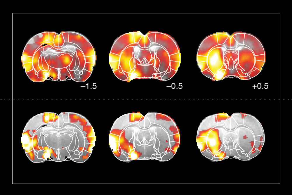 Dopamine response, MIT